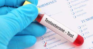 testosterone test