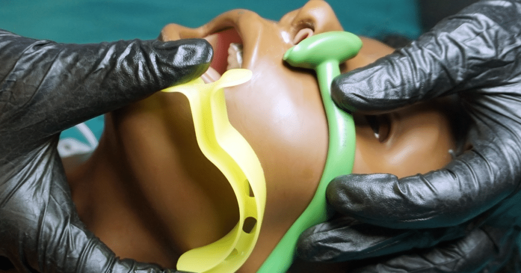 nasopharyngeal airway - NPA