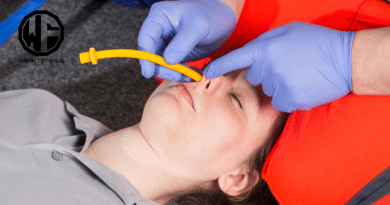 nasopharyngeal airway - NPA