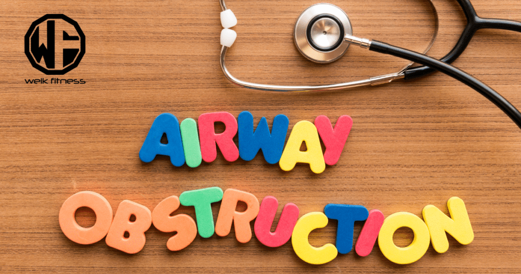 nasopharyngeal airway - NPA