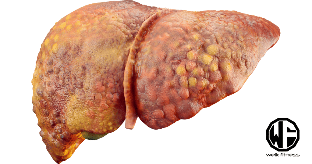 liver shrinking diet