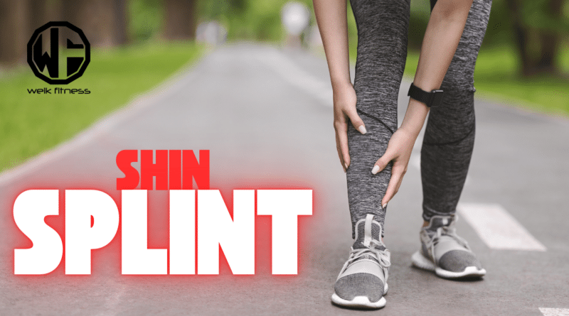 shin splint